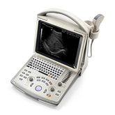 Mindray DP30 Portable Black and White Ultrasound (with optional color or pw)